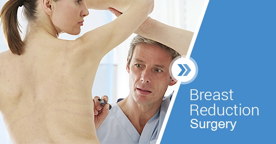 Helpful Information On Breast Reduction Surgeries