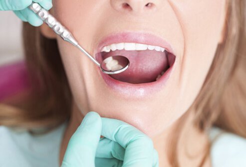 To Know The Most Common Dental Problems - Get In Touch With Us